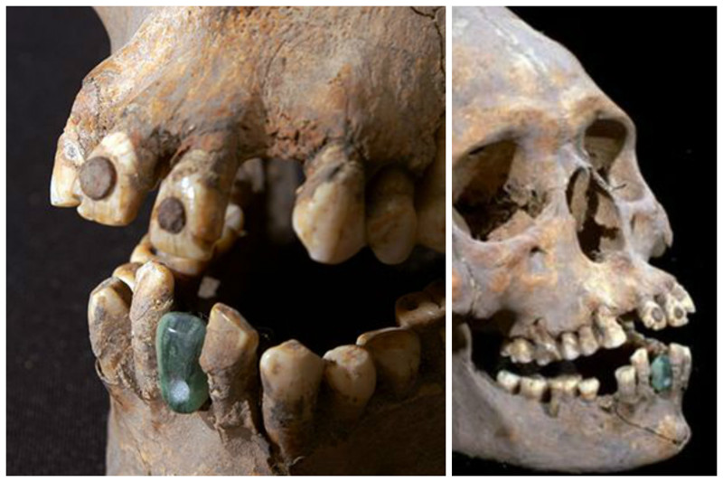 Захоронение женщины в Теотиуакане с зубом из жадеита, который был зацементирован или прикреплен волокном к ее нижней челюсти. 