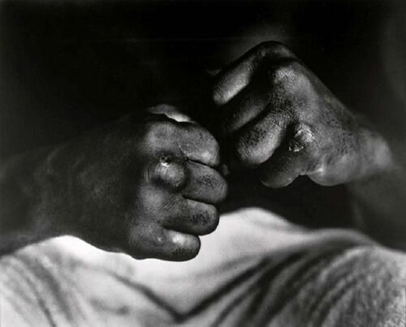 Руки Мухаммеда Али после боя с Генри Купером, 1966 год.