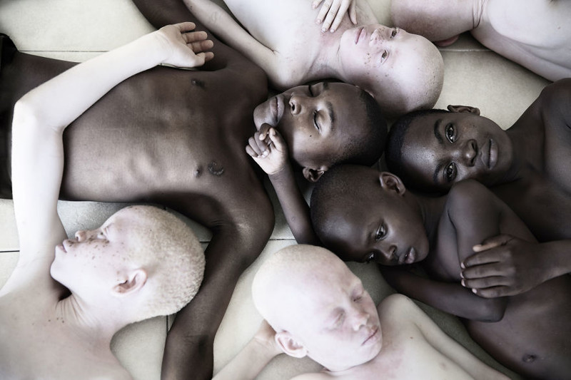 Удивительные портреты альбиносов Танзании, призывающие мир "проснуться"