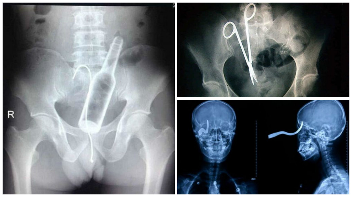 Интересные рентгеновские снимки