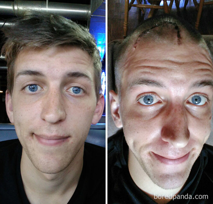 Дети до и после болезни фото