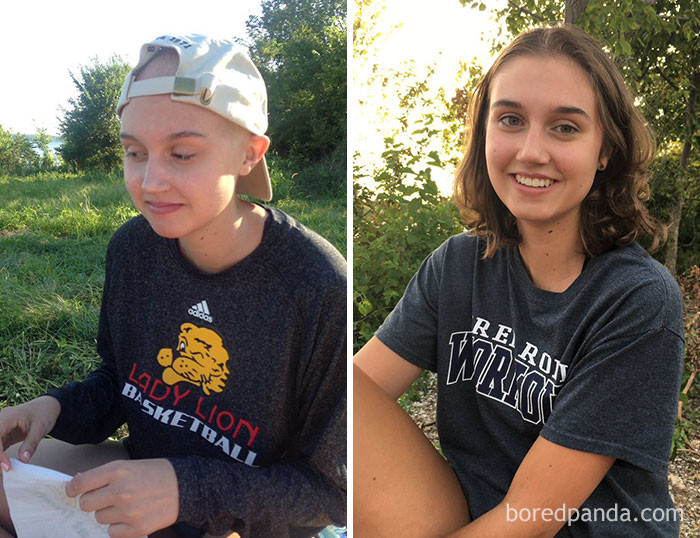 Люди до и после болезни фото
