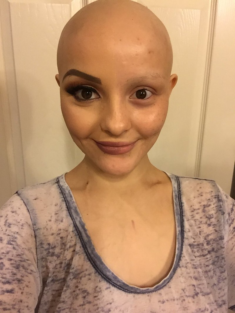 Спустя год после потери волос из-за рака, девушка вернулась и она полностью преобразилась
