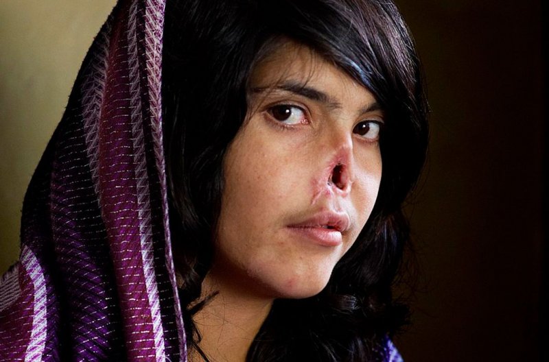 Лицо Аиши изуродовал боевик «Талибана» за попытку побега из семьи, в которой над ней издевались все родственники