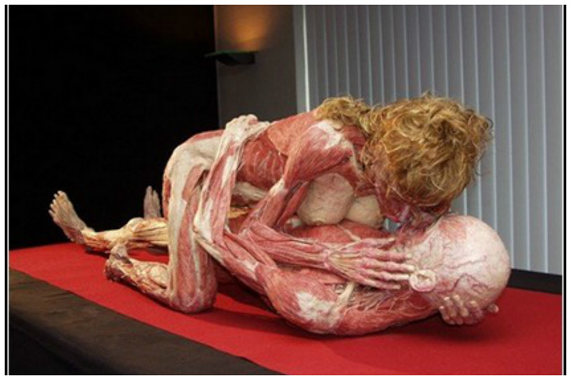 Не для слабонервных! Немецкий художник- патологоанатом Гюнтер фон Хагенс (Gunther von Hagens)  и его музей "Мир тела" (Body world). Трупы настоящие!!!! 