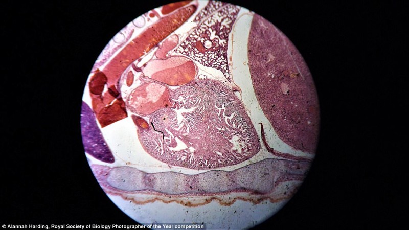 Сердце эмбриона мыши. Фотограф Аланна Хардинг