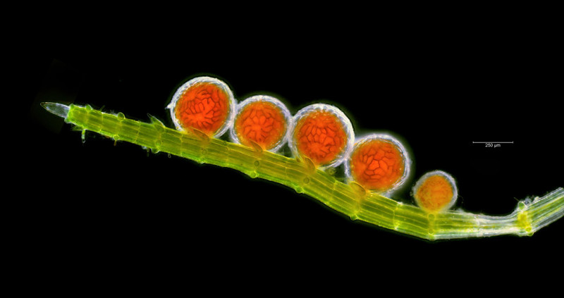 Антеридий — мужской половой орган у споровых растений и грибов. (Фото Chris Carter | 2017 Royal Society of Biology Photographer of the Year):