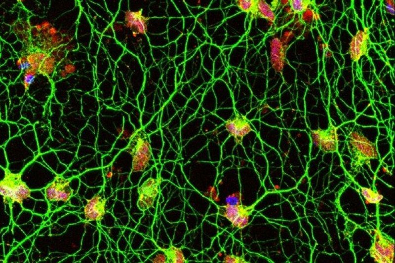 Моторные нейроны