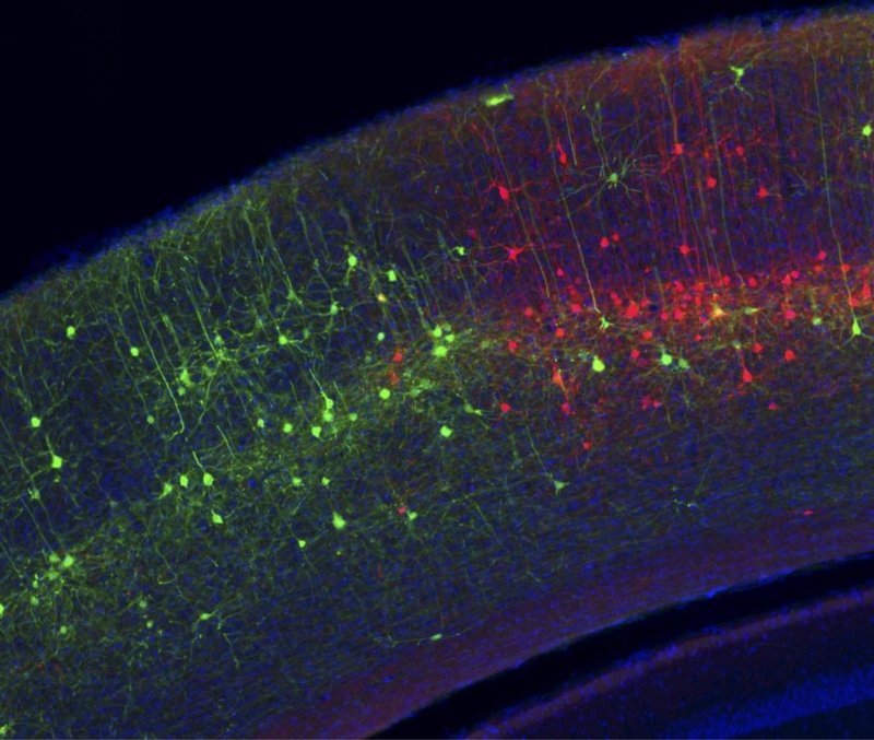 Клетки мозга мыши