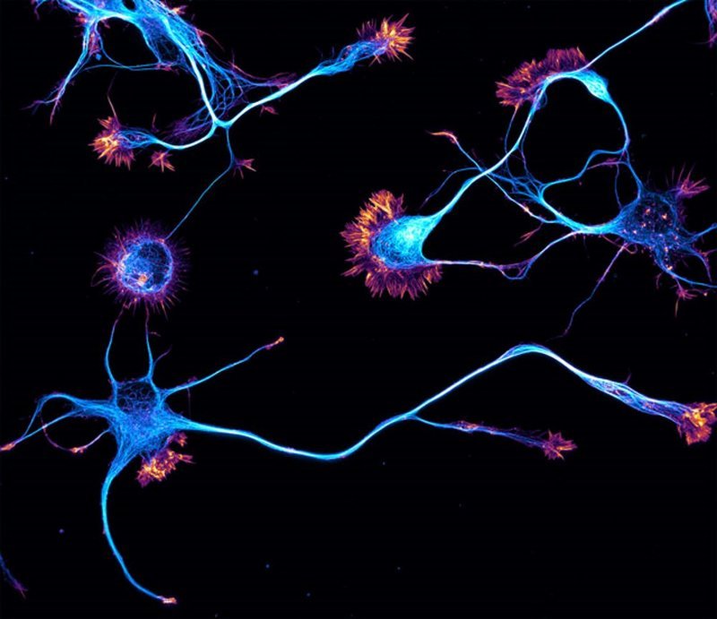 Нейроны гиппокампа крысы