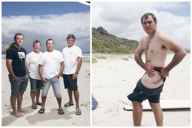 Четверо мужчин, каждый из которых подвергся нападению акул, создали свой Bite Club в котором оказывают всяческую помощь тем, кто пострадал от акульих атак