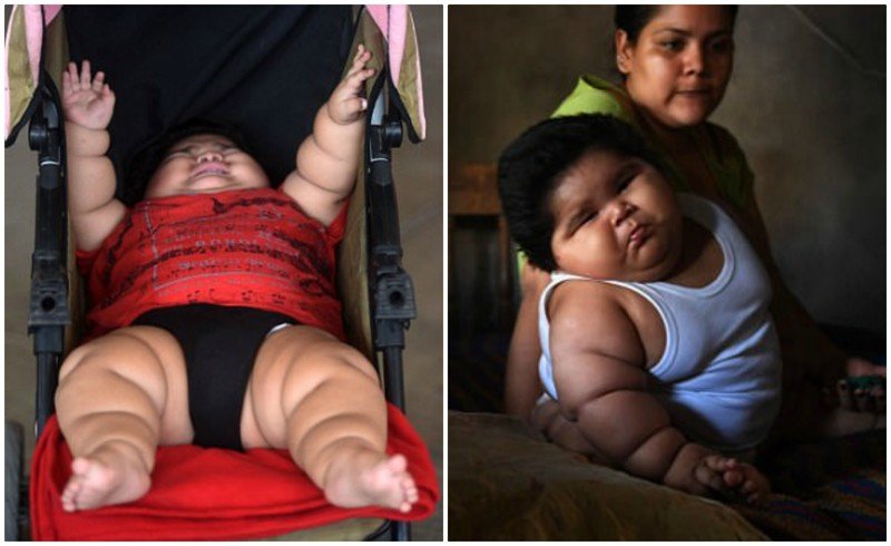 10-месячный мальчик из Мексики весом 28 кг — самый толстый ребёнок в мире
