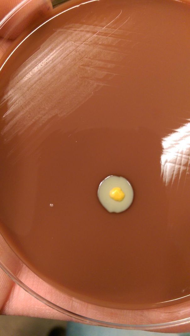Не яичница, а рост бактерий в чашке Петри