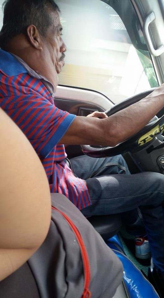 Водитель такси, 15 лет проживший с огромной опухолью на шее, был прооперирован благодаря случайному пассажиру