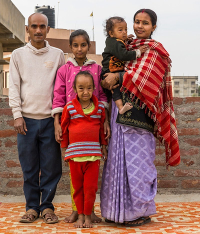 Семейная трагедия: сразу двое детей страдают от прогерии