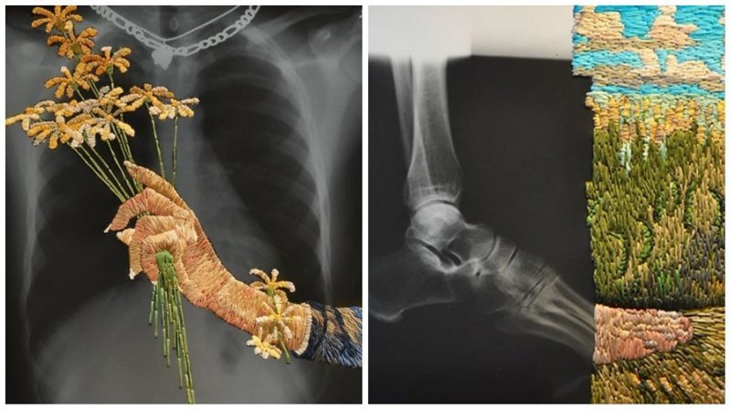 Рентгеновская пленка и вышивка: необычные картины Мэтью Кокса