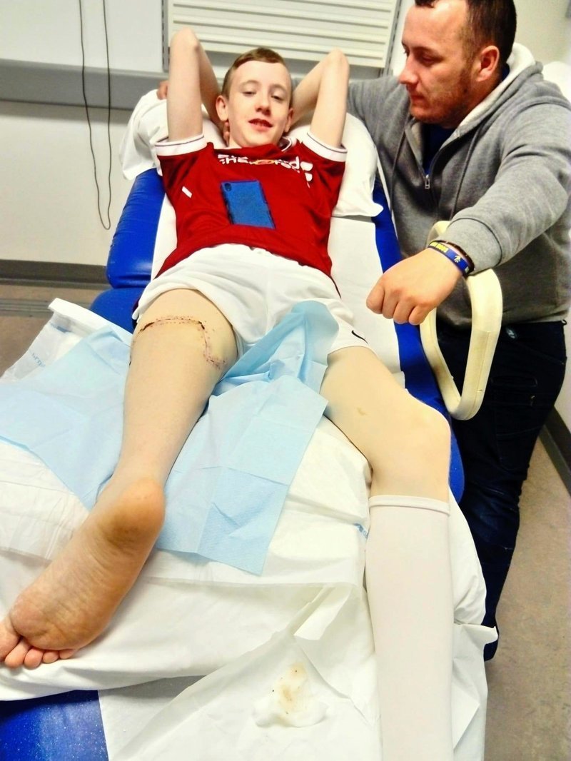 Хирурги пришили ребенку ногу задом наперед, чтобы он мог играть в футбол