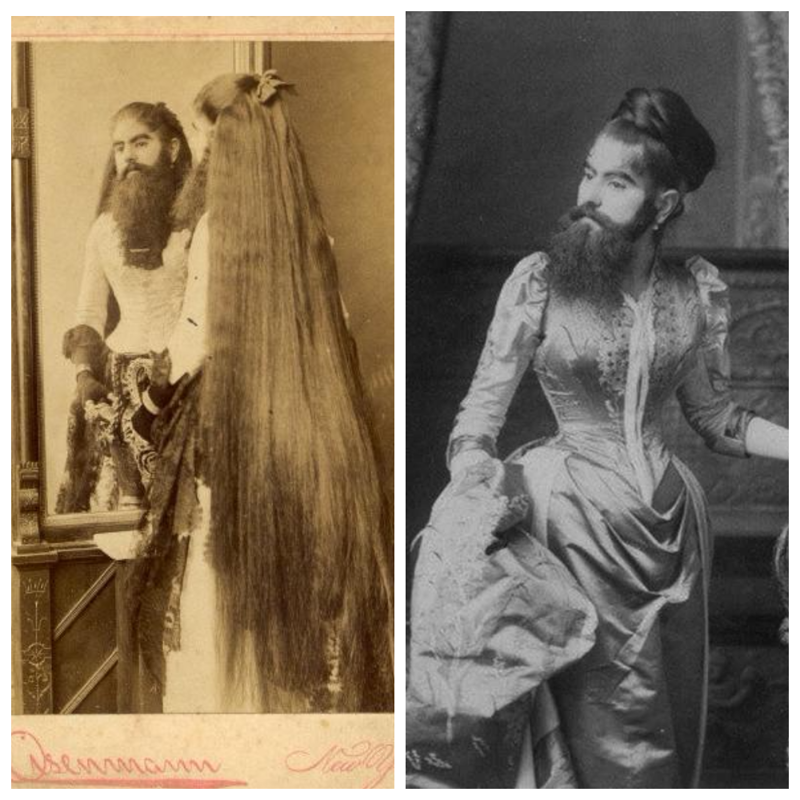 «Бородатая девочка» Энни Джонс. Фото примерно 1880-х годов.