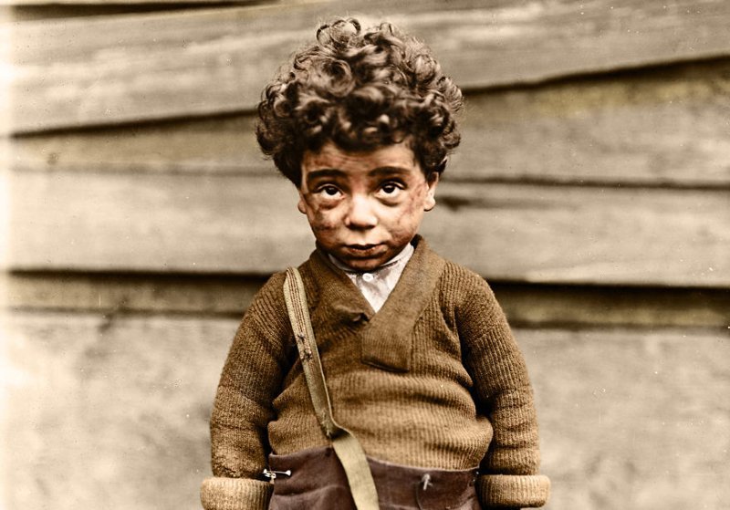 Мальчик-нищий, Чикаго, 1910г.