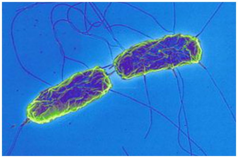 Тиф брюшной  — представляет острую инфекционную болезнь, обусловливаемую проникновением в лимфатический аппарат кишок особого микроорганизма, известного под названием Кох-Эбертовской бациллы