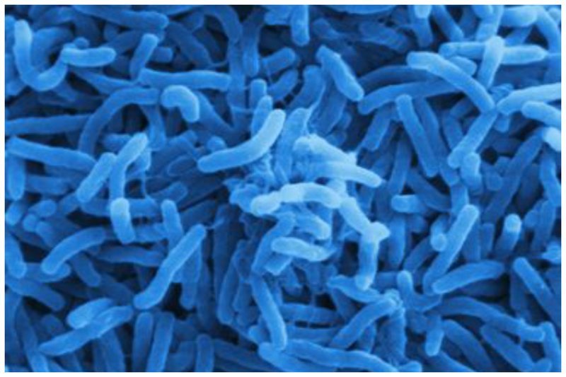 Холера — острая кишечная, сапронозная инфекция, вызываемая бактериями вида Vibrio cholerae.
