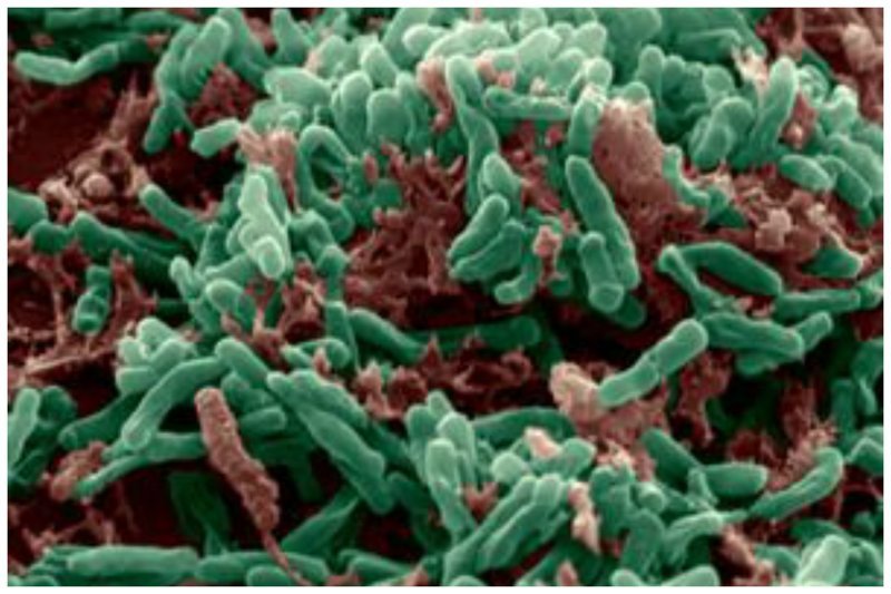 Возбудителем туберкулеза является бактерия Mycobacterium tuberculosis, которая чаще всего поражает легкие. Туберкулез распространяется от человека человеку по воздуху -при кашле, чихании или отхаркивании люди с легочным туберкулезом