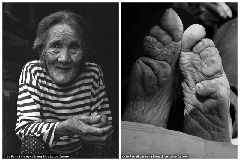 Као Мей Инг, 87 лет. Перенесла бинтование ног в 3-летнем возрасте. Перестала носить бинты 74 года спустя