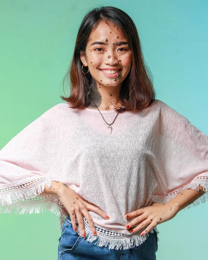 21-летняя малазийка со множеством родинок прославилась благодаря внешности