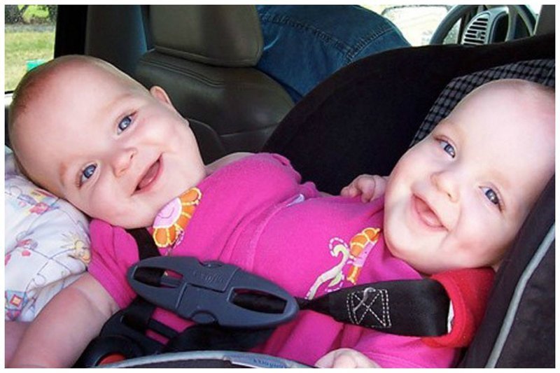 Три сестрички Мэйси, Макензи и Мэдлин родились в Калифорнии, первые две из них оказались сиамскими близнецам