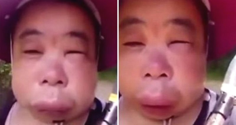 Женщина сняла опухшее лицо на видео и опубликовала кадры в соцсети