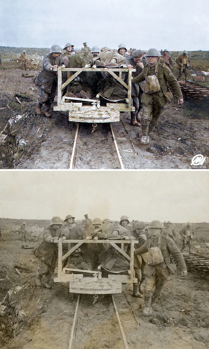 Перевозка раненых в битве при Вими, апрель 1917 года