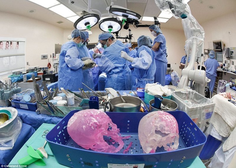 В 31-часовой операции по пересадке лица участвовали 11 хирургов