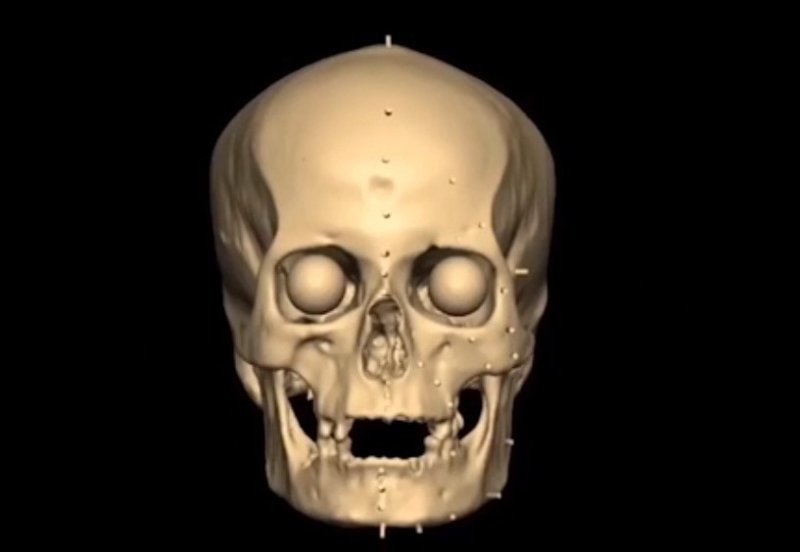 Магистрантка сделала 3D-копию черепа, который находится в Анатомическом музее Эдинбурга
