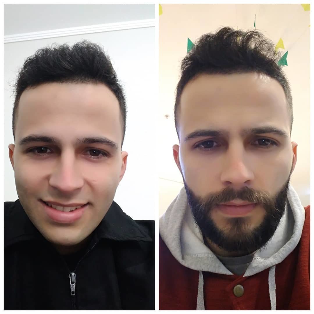 До и после бритья бороды