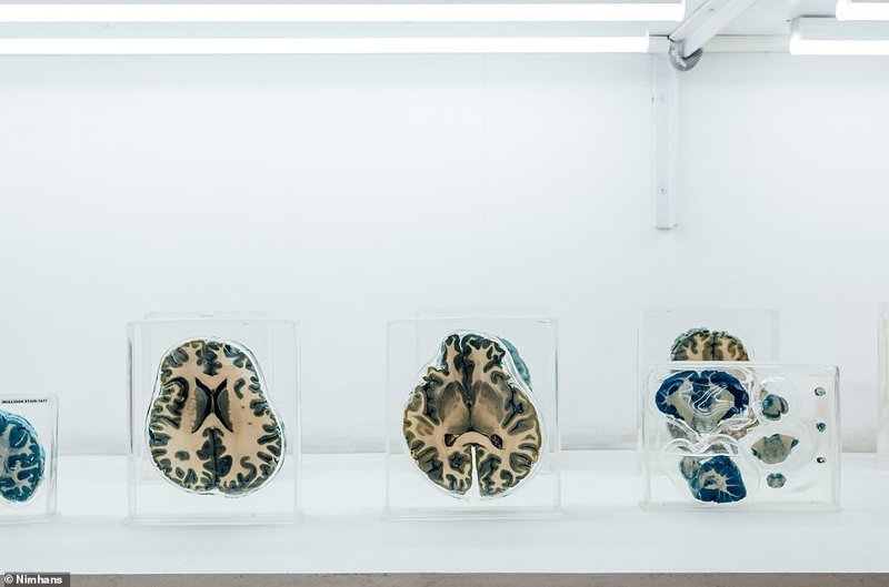 В Индии открылся Музей мозга, в котором экспонаты можно потрогать
