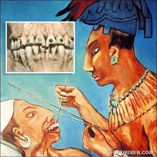 Лечение зуба в древности thumbnail