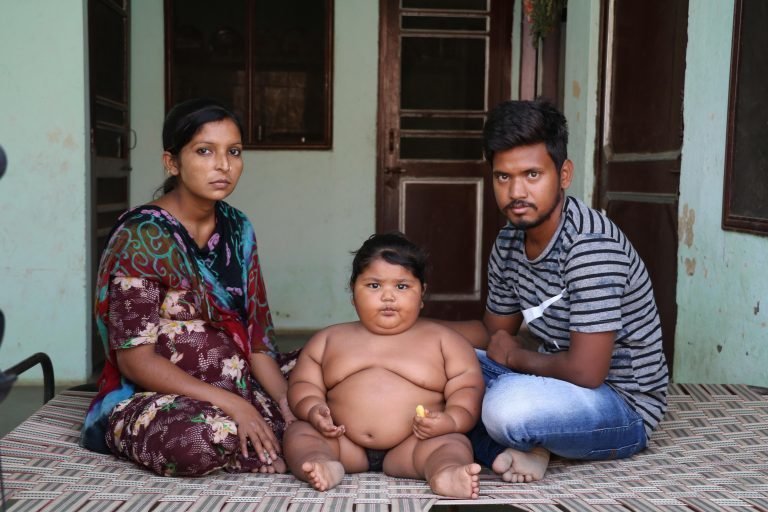 16-месячный ребенок весит 25 кг из-за редкого врожденного дефекта