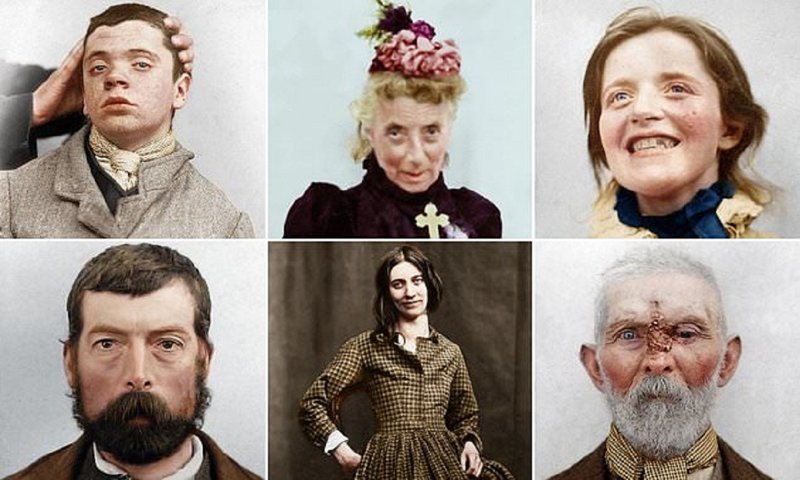 Пациенты психушек викторианской эпохи: истории в фотографиях