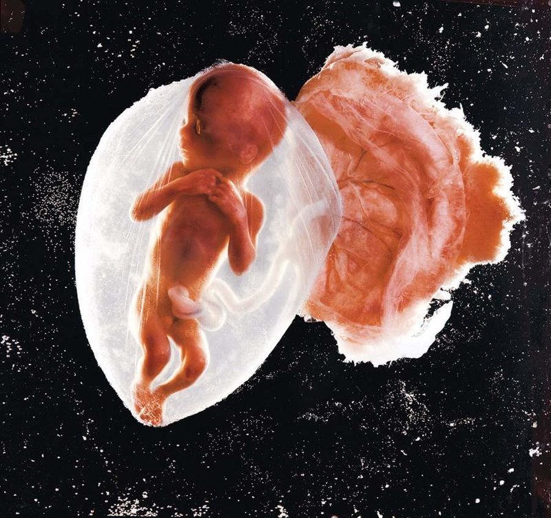 Эмбрион, 18 недель, Леннарт Нильсон, 1965. 