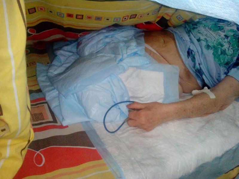 Отрезали не ту ногу: родственники ветерана в шоке от воронежских врачей