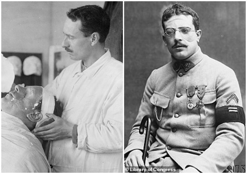 Пластическая хирургия Первой мировой: как хирурги восстанавливали изуродованные лица солдат