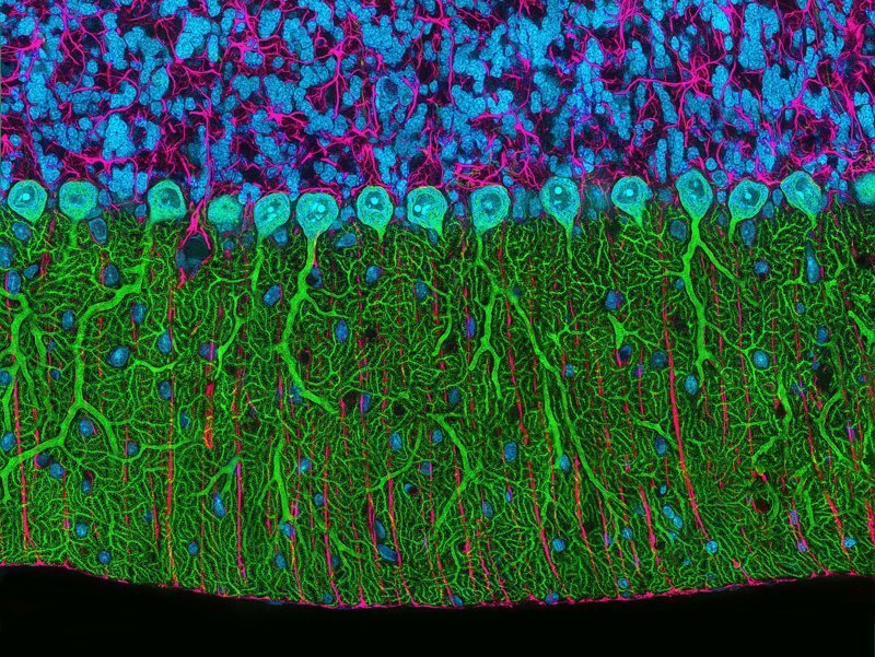 Нейроны Пуркинье (клетки Пуркинье)