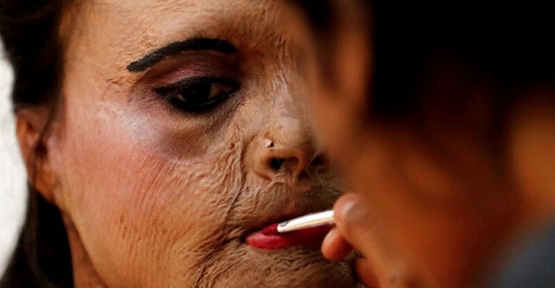 Женщина пострадала от кислотной атаки, а теперь ей наносят макияж перед показом мод к Международному женскому дню в Мумбаи