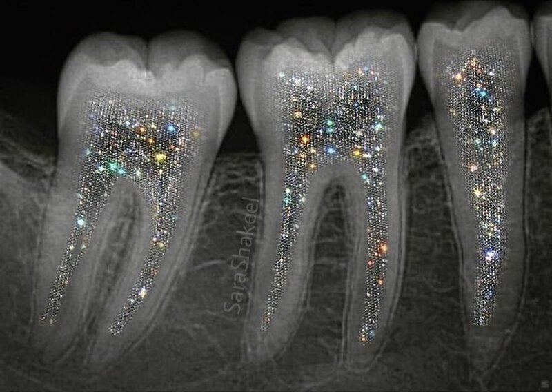 Девушка из Пакистана бросила свою работу зубным врачом и начала клеить блестки на все, что можно