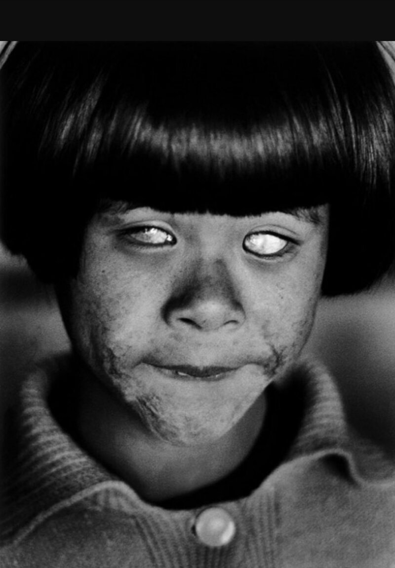 Так выглядят глаза человека который видел вспышку атомного взрыва