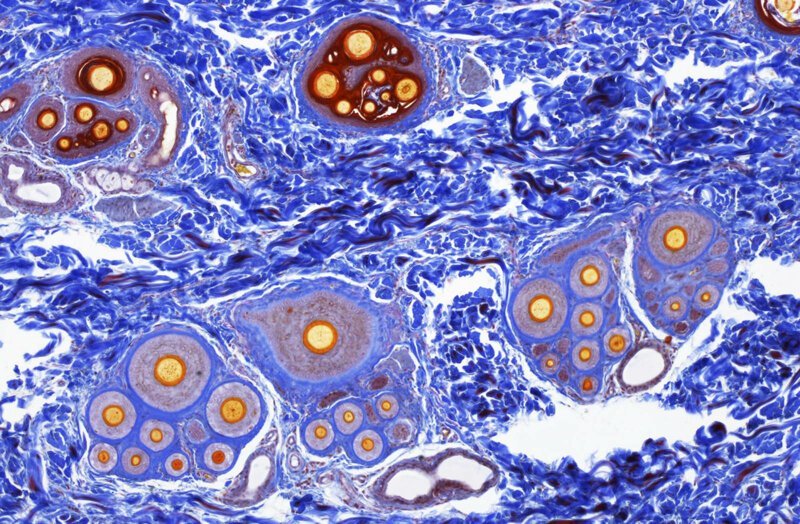 Ученые нашли клетку, вызывающую рак