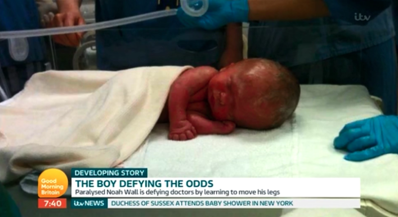Мальчик, родившийся без мозга, опроверг прогнозы врачей