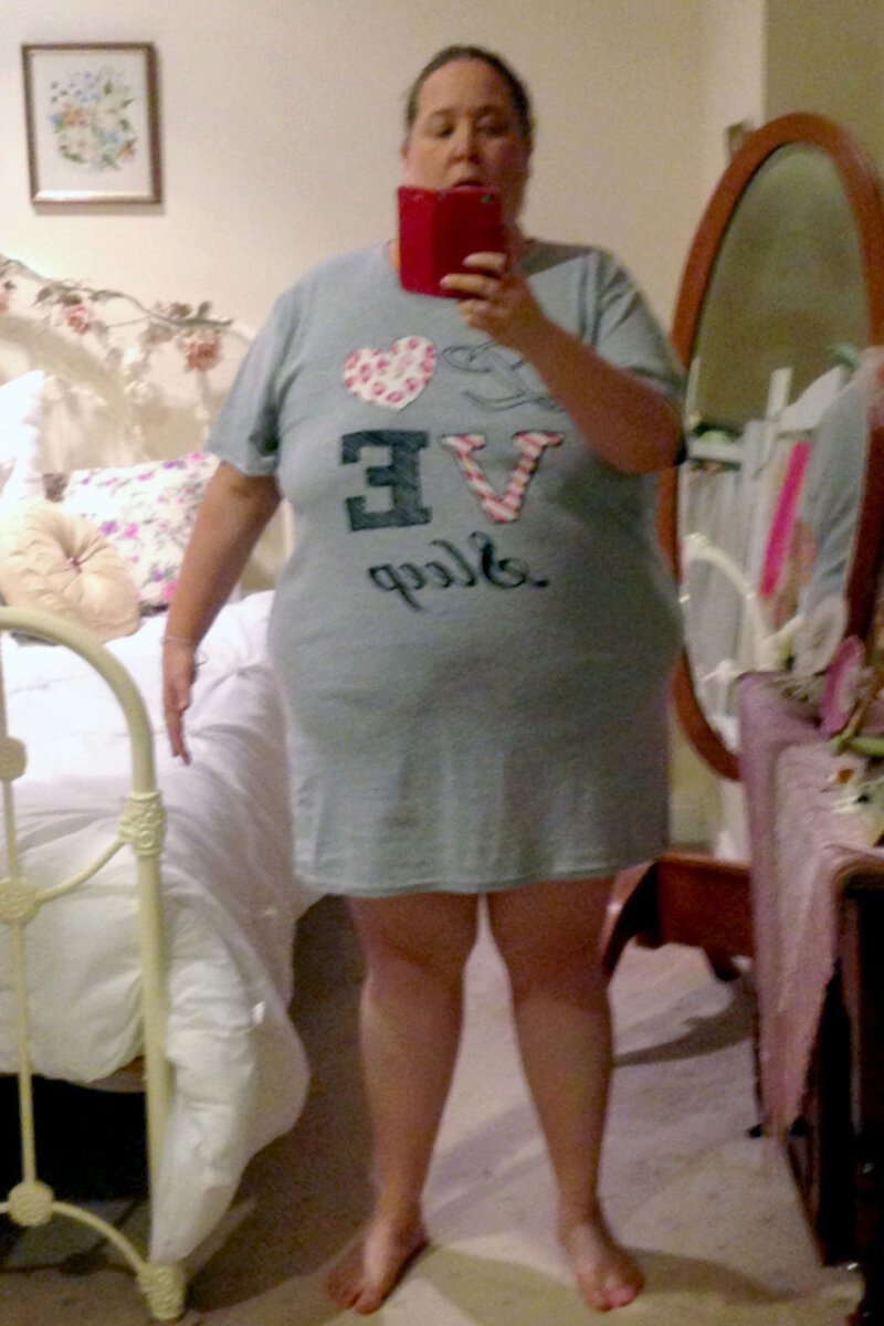 Невероятная потеря веса: женщина похудела на 100 кг, чтобы выжить