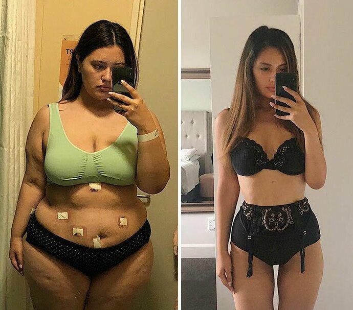 Фотографии до и после похудения (30 фото)