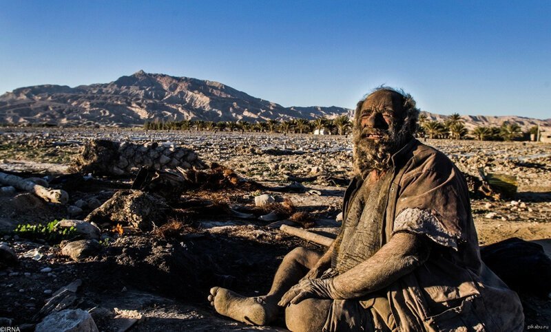 Аму Хаджи, человек который не мылся более 60-ти лет, ничем особенным не болел т является феноменом, занесенным в книгу ГИнесса, как самый грязный человек мира